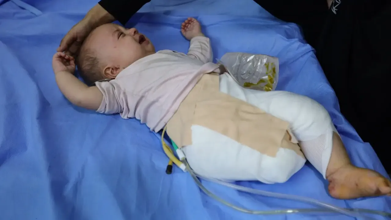 İsrail'in saldırısında ayağını kaybeden 4 aylık bebek, yaşama tutunmaya çalışıyor