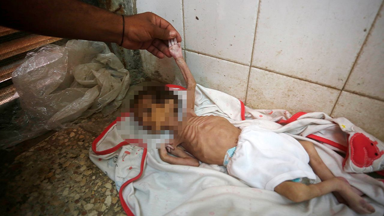 Gazze'de iki bebek daha açlıktan şehit oldu