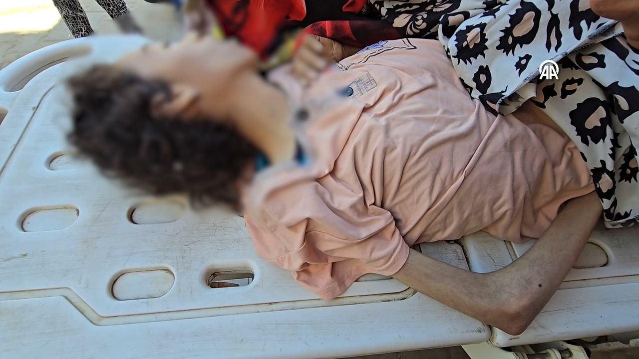 Gazze'de bir kız çocuğu daha açlıktan hayatını kaybetti