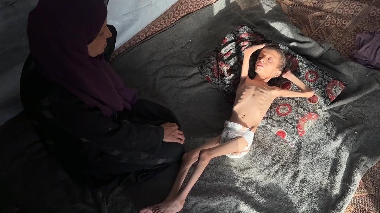 İsrail'in açlık silahı: 10 yaşındaki Nafaz 4 aylık bebeğe döndü