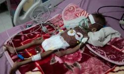 DSÖ: Yemen'de dünyanın en kötü krizlerinden biri yaşanıyor