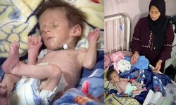 1.5 kilo Gazzeli Yusuf, açlığa yenik düştü