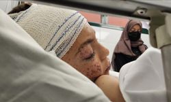 Filistinli doktorun yaşayan son çocuğu İtalya'da tedavi edilecek