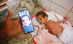Gazze'de 3 aylık bebek Curi açlıktan öldü