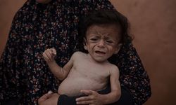 BM: Gazze'de insanların açlıktan ölmesi sıradan bir olay haline geldi