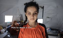 İsrail, Gazze'de binlerce kişiyi kör etti