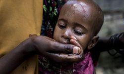 DSÖ: Sudan'da kolera nedeniyle 2 bin 741'den fazla ölüm bildirildi