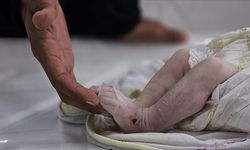 Gazze'de bir bebek daha açlıktan yaşamını yitirdi