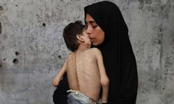 Gazze'de açlıktan ölenlerin sayısı 131'i çocuk olmak üzere 367'ye yükseldi