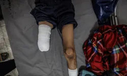 Gazze'de 22.000 yaralı tıbbi tahliye listelerinde