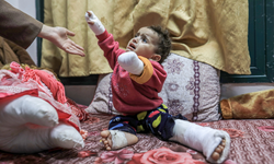 Gazze'de vahim durum: 6000 amputasyon vakası