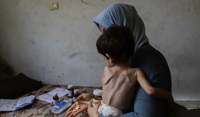 BM: Gazze'de nüfusun yaklaşık 96'sı "aşırı açlık" anlamına gelen gıda güvensizliğiyle karşı karşıya