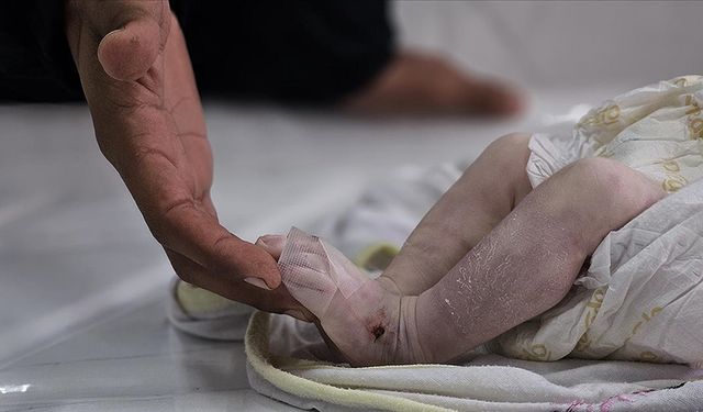 Gazze'de bir bebek daha açlıktan yaşamını yitirdi