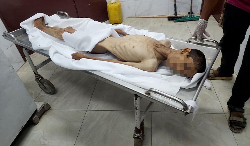 Gazze'de kıtlık: Son 24 saatte 8 ölü